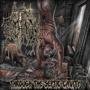 Purulent Incision