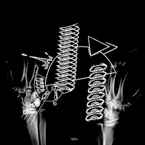 LIVELEAK KING (feat. Saint Sleep)