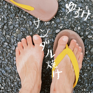 サンダル焼け