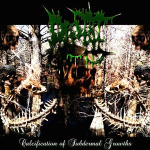 Fibrodysplasia Ossificans Progressive Remastered