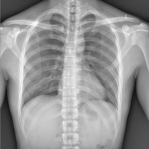 《輪回》（Reincarnation）