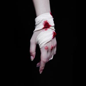 GOLPE (feat. Monobloc)