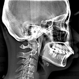 矫正（Prod.AllenJ)