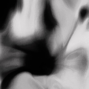 Vertigo boundary