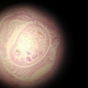 那么多唉（病理学复习有感）