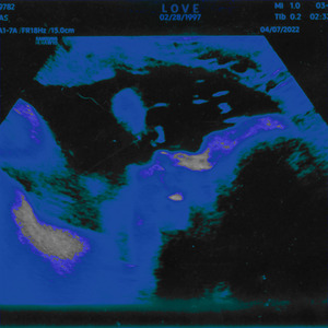 Who Wouldn't Let the Beat Cry?