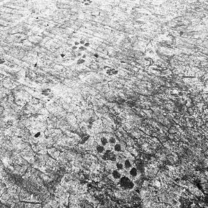 在失去意识的最后一瞬，我想起了当年那个穿着白色连衣裙的女孩