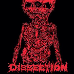 DISSECTION