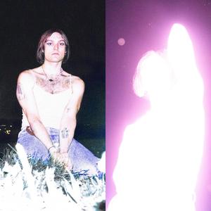 I Tried To Cut My Arm Off Last October