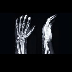 broken wrist (feat. Geekinz)