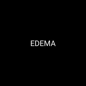 Edema