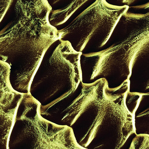 Sedimentation