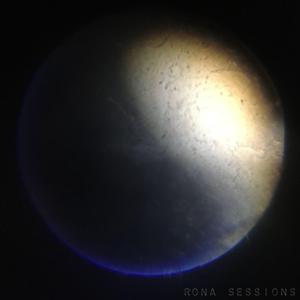 Shattered Kitchenware