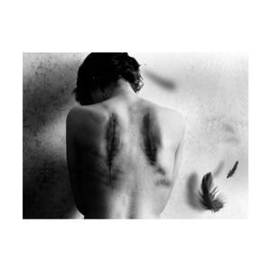 Scars Of The Past