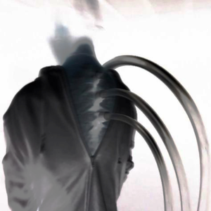 "Overdose Pt.3" - 6LACK Type Beat