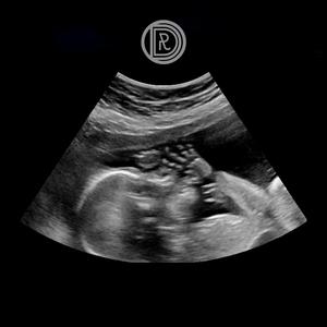 Съм (feat. Sashhh)