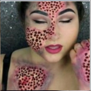 Trypophobia