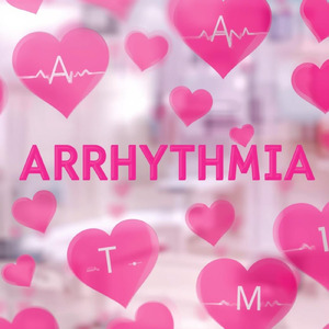 Arrhythmia