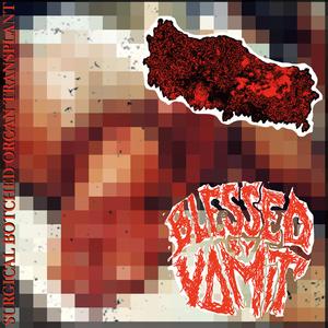 Coughing Up Gangrenous Chunks