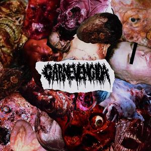 Necrotizing Fasciitis