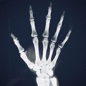 Skeleton Hands