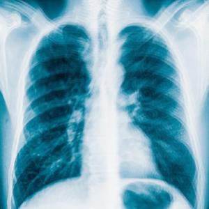 asthmatic (feat. creepies)