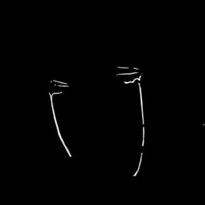 Sad X Emotional Beat (Crying in the Rain)