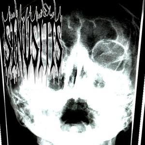 nasopharynx