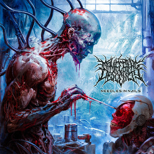 Needles in Nails (Single Version)