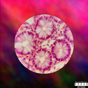 Electroestimulación.