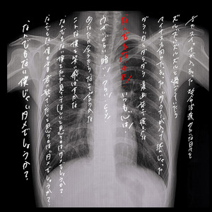 なんでもない (のに)