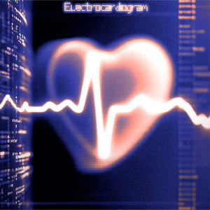 Electrocardiogram（心电图）
