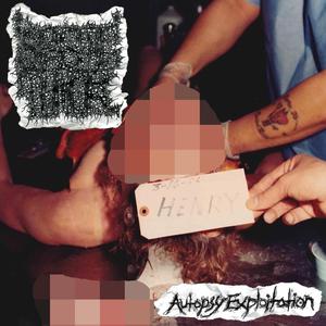 Symphonies for Grind-Gutting Regurgitation of a Decomposed Gastrointestinal Tract, Resulting in Vomitfied Tumorous Necropsy