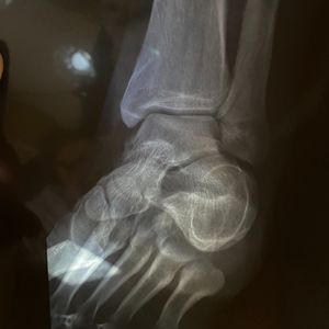 Stupid Cupid remix feat. 茅子