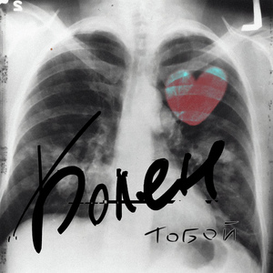 Болен тобой