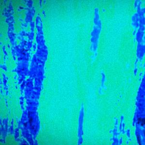 b e t w e e n d r e a m s (interlude)