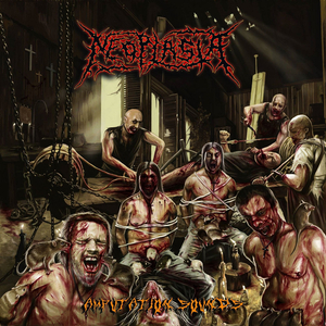 Congenital Adrenal Hyperplasia