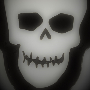 Skull Fracture