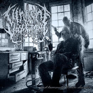 Phocomelia by a Thalidomide Effect