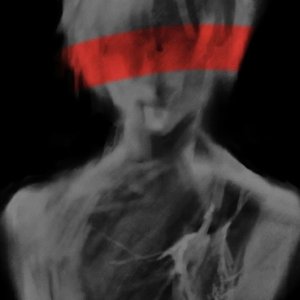 The London (remix)(prod.byMEGA))