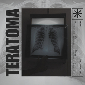 Teratoma
