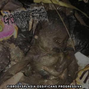 FIBRODYSPLASIA OSSIFICANS PROGRESSIVA