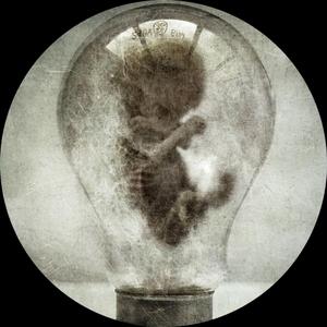 Void the C-Stem (Vsk Remix)