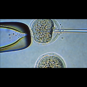 Somatisk celle klone menneske