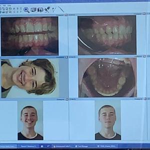 Ada Houseless Orthontonus