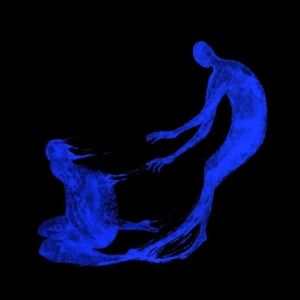 亲密是陷阱(爱的人拿最锋利的刀刺我心里)