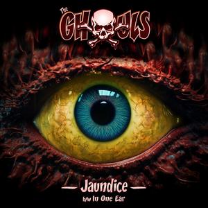 Jaundice