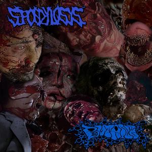 Postural Liquefaction Syndrome / Ligamentous Tissue Meltdown / Hernia Hellstorm