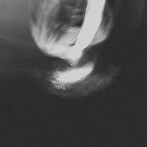 the day that you died