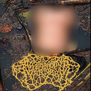 Choking on the Fluoroantimonic acid covered intestinal remains